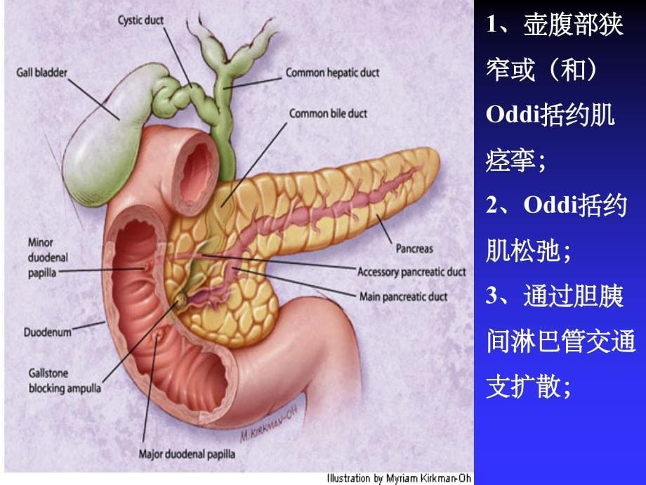 急性胰腺炎优秀ppt课件_第5页