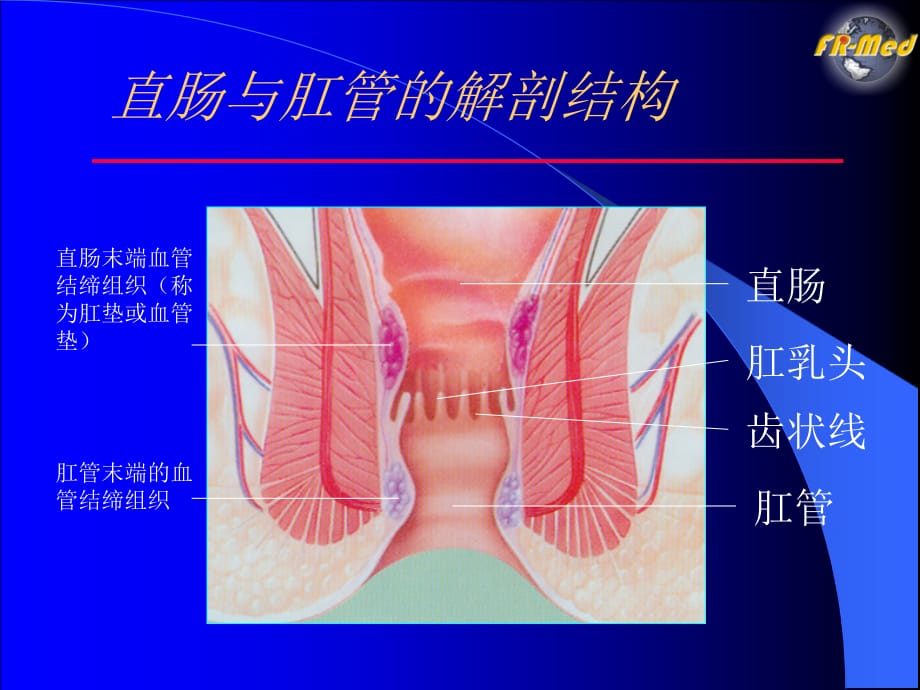 痔疮与套扎治疗复件ppt课件课件ppt_第2页