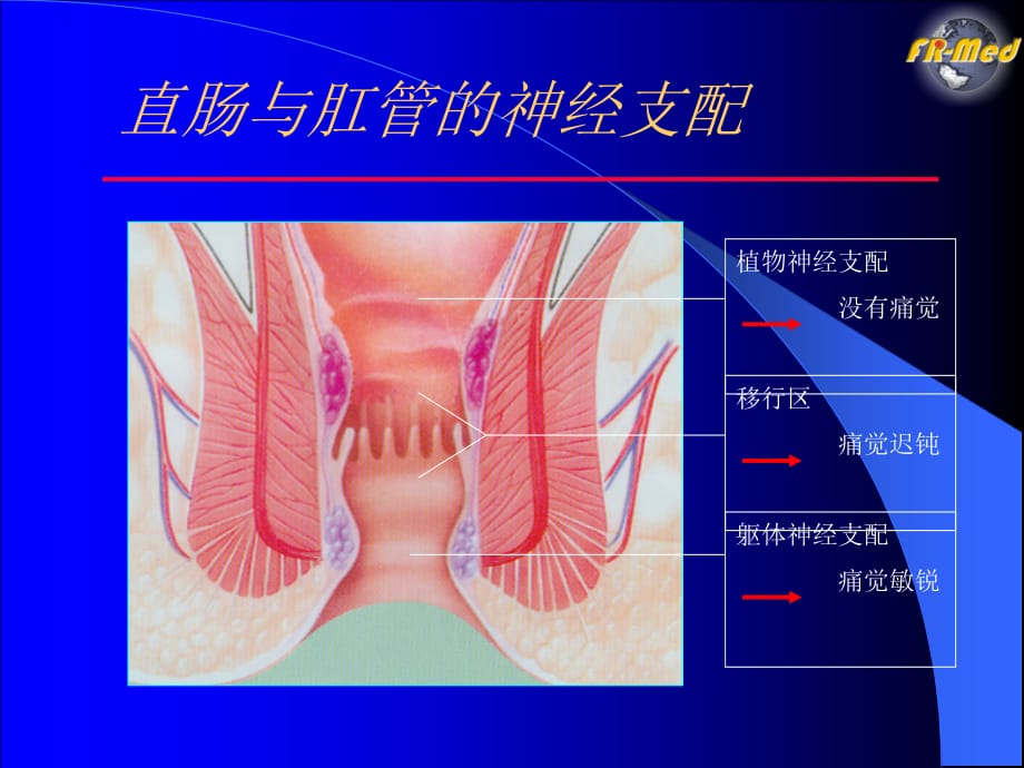 痔疮与套扎治疗复件ppt课件课件ppt_第3页