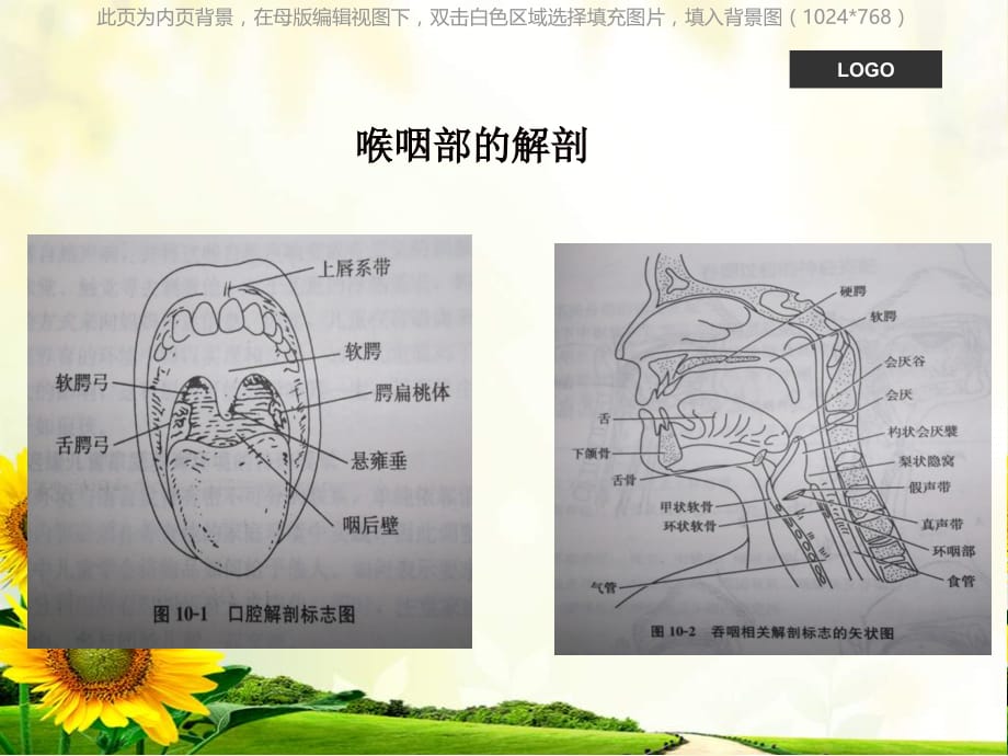 吞咽困难护理查房ppt课件课件ppt_第2页