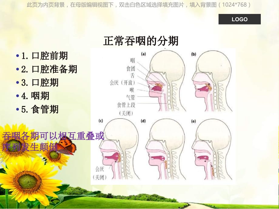 吞咽困难护理查房ppt课件课件ppt_第3页