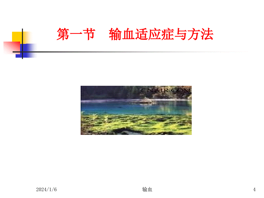 输血适应症与安全输血课件ppt_第4页