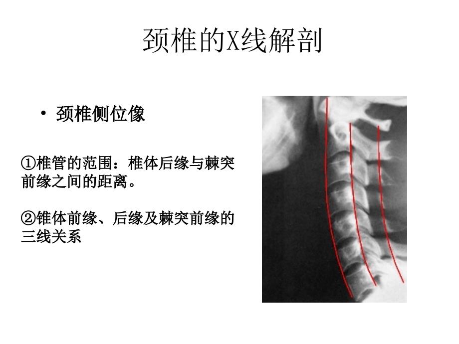 脊柱的线解剖精课件ppt_第3页