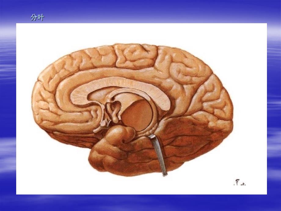 大脑解剖结构课件ppt_第4页