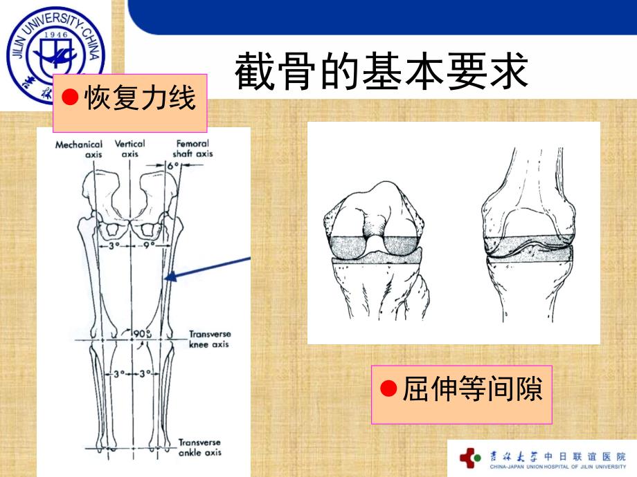 全膝关节置换的截骨原则精编版_第3页