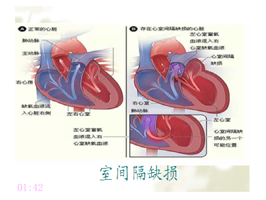 常见重要脏器疾病课件ppt_第4页