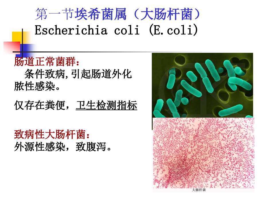第章消化道感染细菌课件ppt_第3页