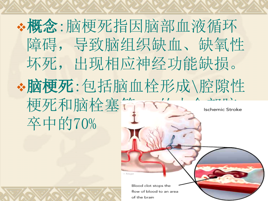 脑梗死诊断、影像学、治疗课件ppt_第2页