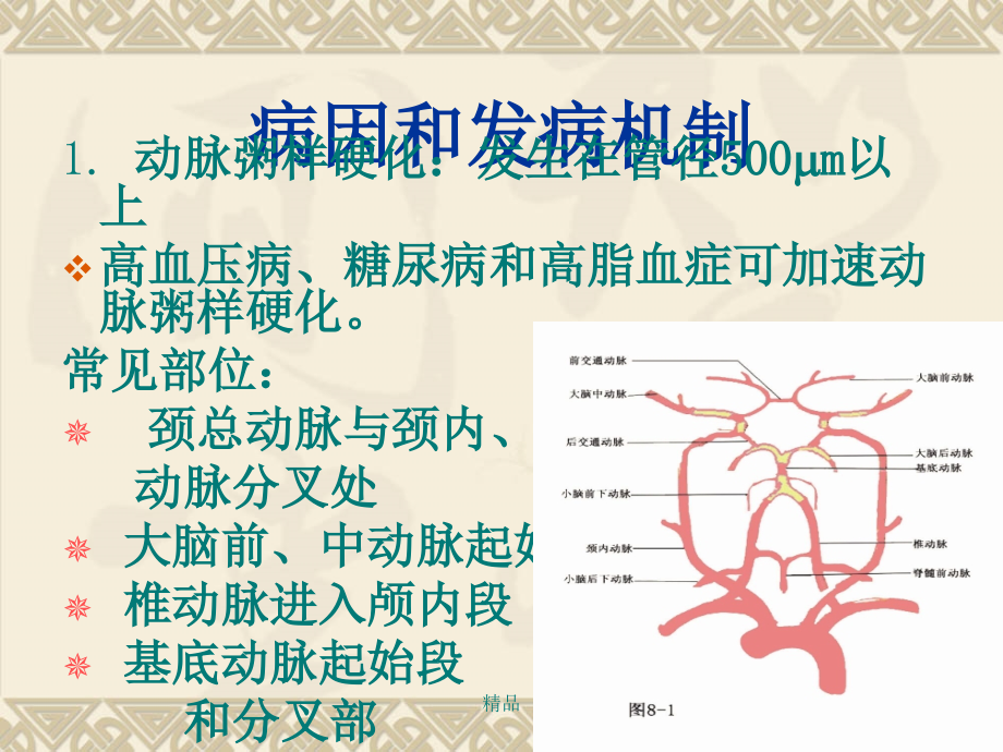 脑梗死诊断、影像学、治疗课件ppt_第4页