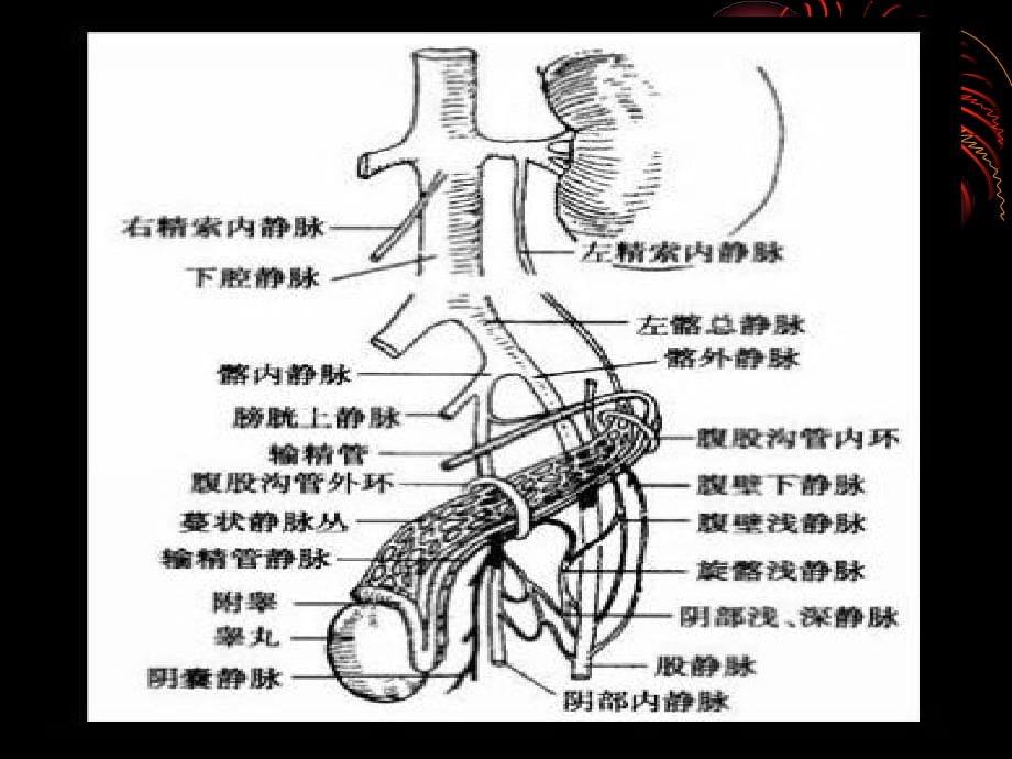 精索静脉曲张演示文稿课件ppt_第5页