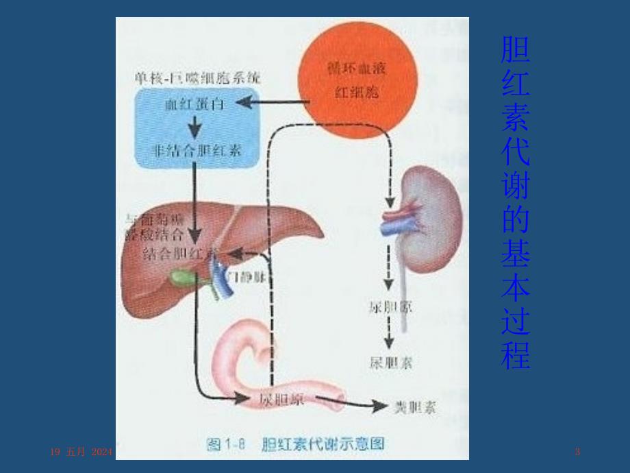 黄疸的鉴别诊断课件ppt_第3页