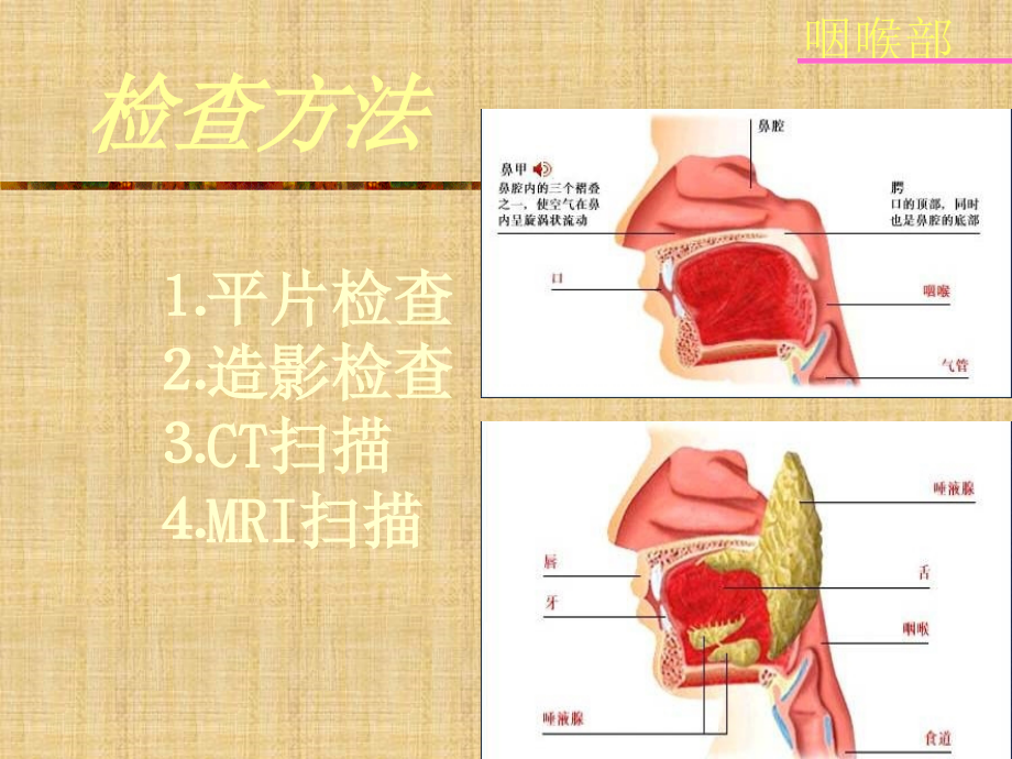 鼻咽及喉部影像学诊断精编版_第3页