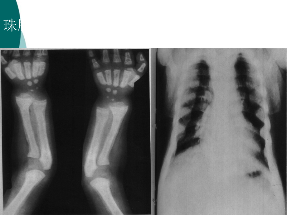 骨关节系统影像诊断学实习片库-2课件ppt_第4页