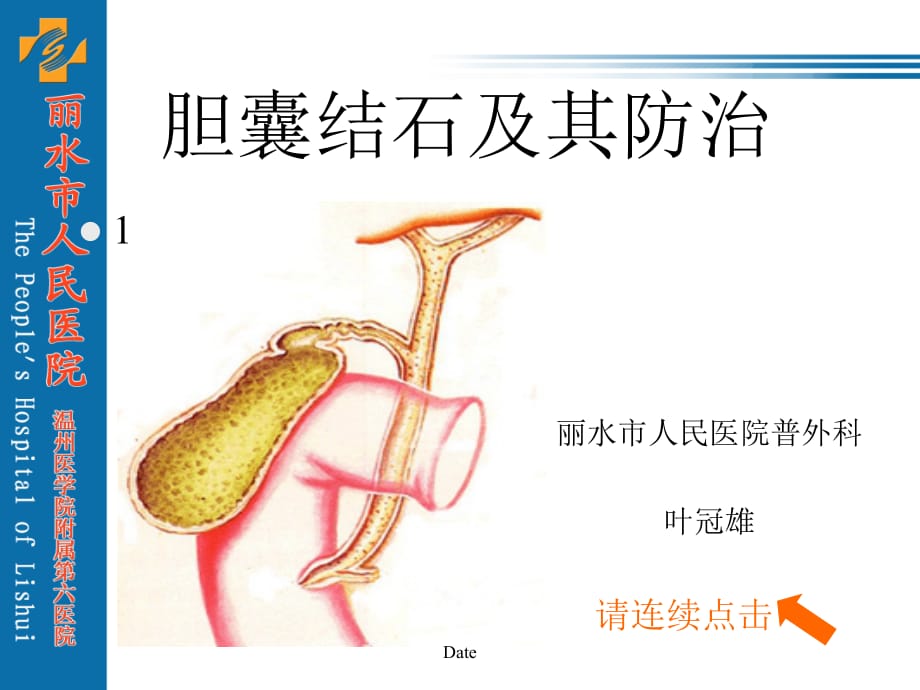 胆囊结石及其防治.教学文案_第1页