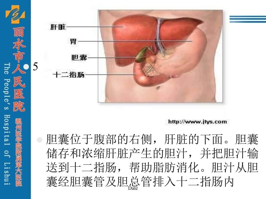 胆囊结石及其防治.教学文案_第5页