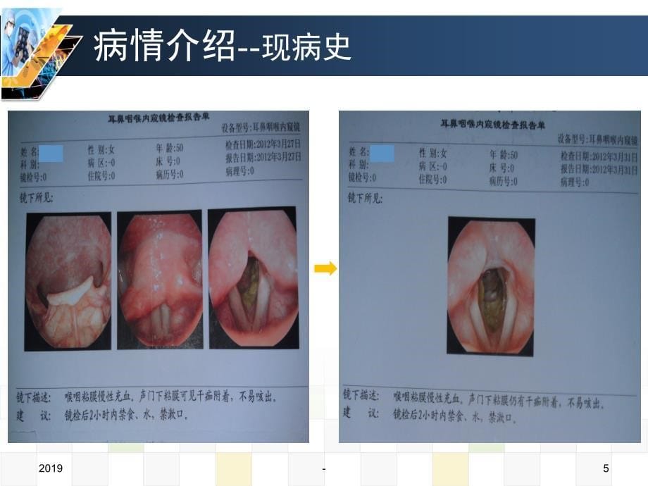 病例分享河北医科大学第二医院李雪ppt课件_第5页