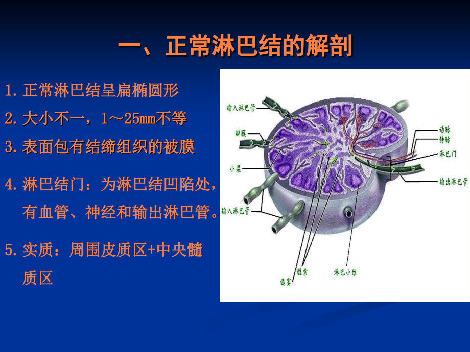 浅表淋巴结超声诊断ppt课件_第3页