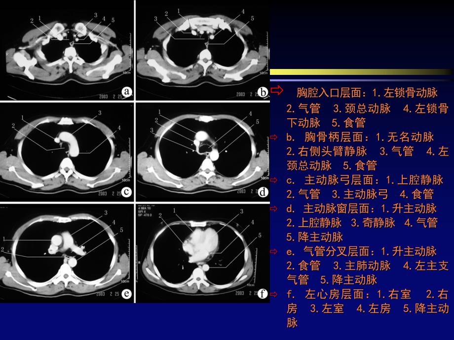 肺部疾病的诊断ppt课件_第2页