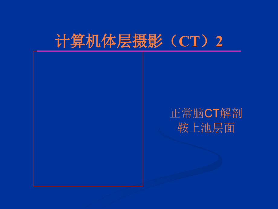 脑部疾病影像诊断学ppt课件_第4页