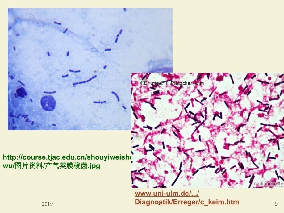 第十节-产气荚膜梭状芽孢杆菌检验_第5页