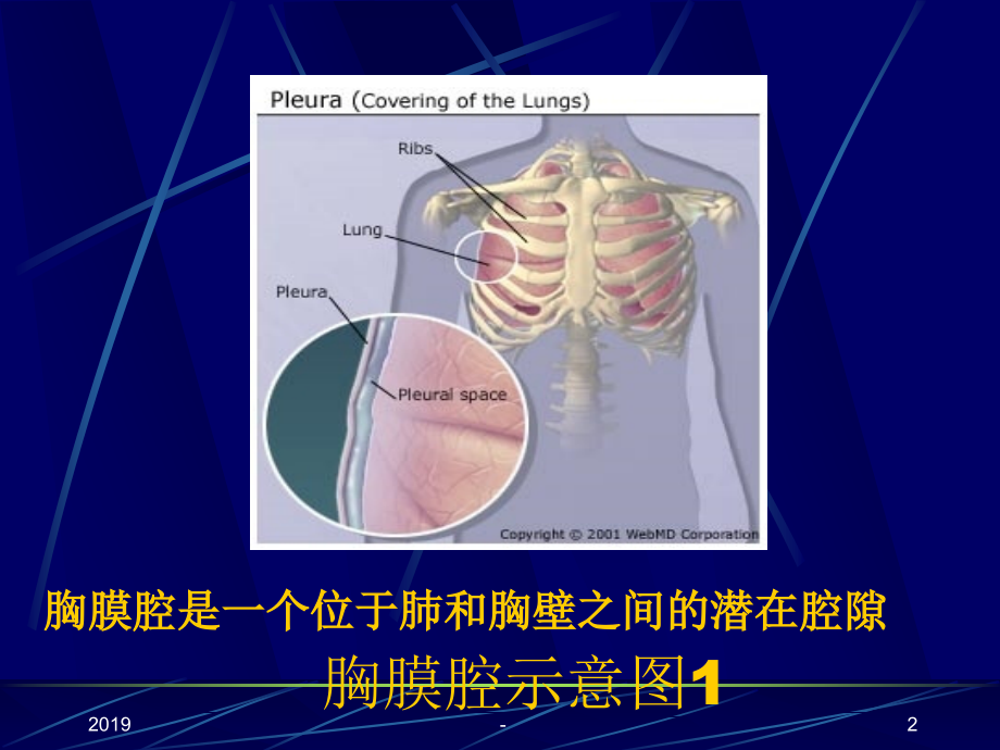 胸腔积液教案版ppt课件_第2页