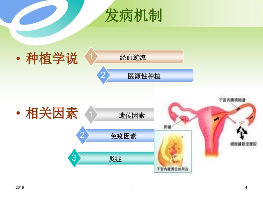 子宫内膜异位症的护理ppt课件_第4页