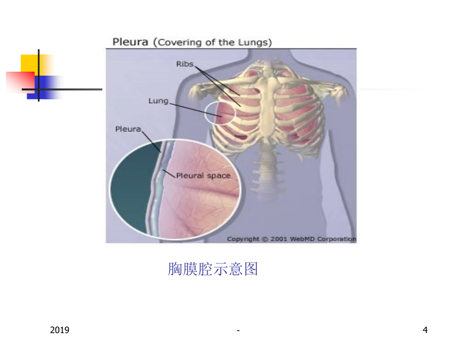 胸膜疾病的诊断与治疗ppt课件_第4页