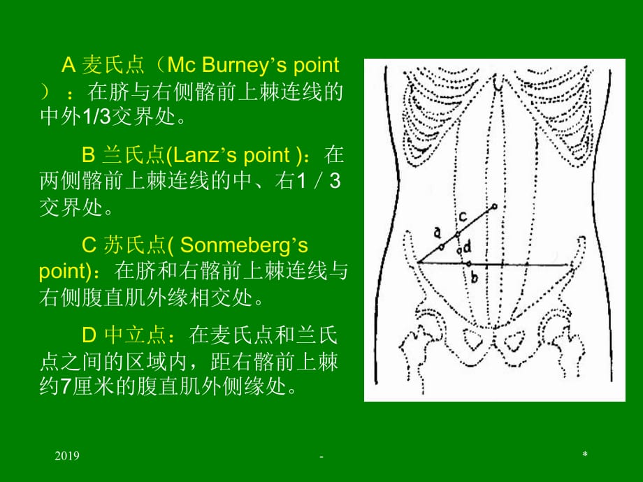 第二十二章阑尾炎ppt课件_第5页