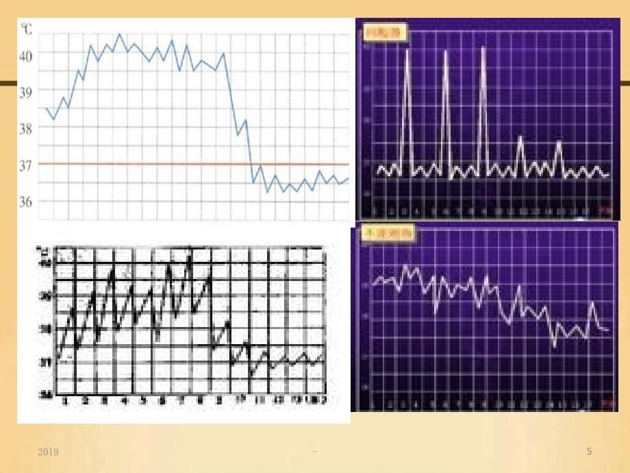 高热病人的护理ppt课件_第5页