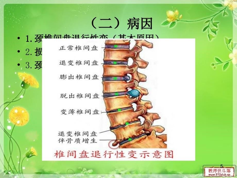 颈椎病康复护理PPT幻灯片课件_第5页