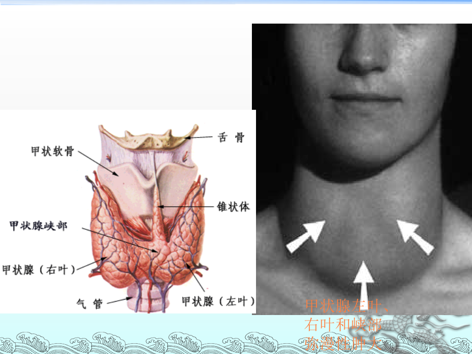 甲亢性心脏病ppt课件_第2页