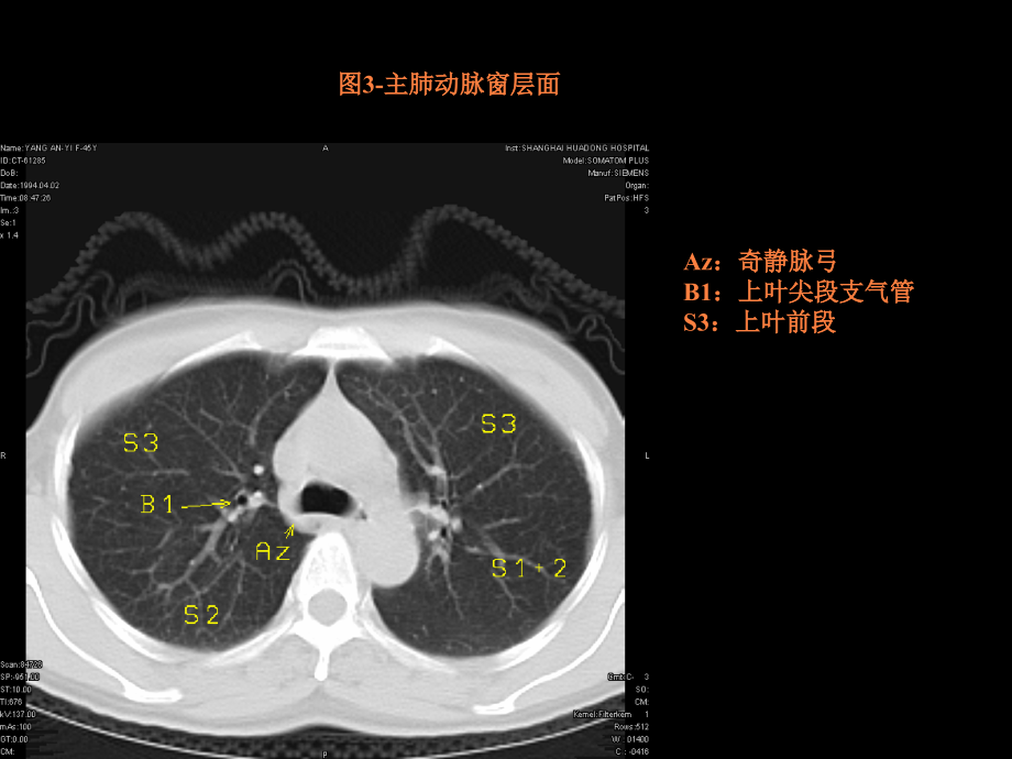 教学幻灯片胸部华东医院室ppt课件_第4页