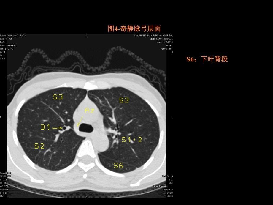 教学幻灯片胸部华东医院室ppt课件_第5页