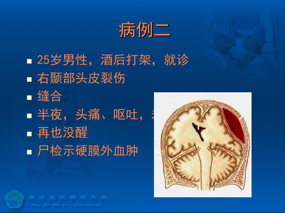 颅内压增高邱炳辉PPT课件_第4页