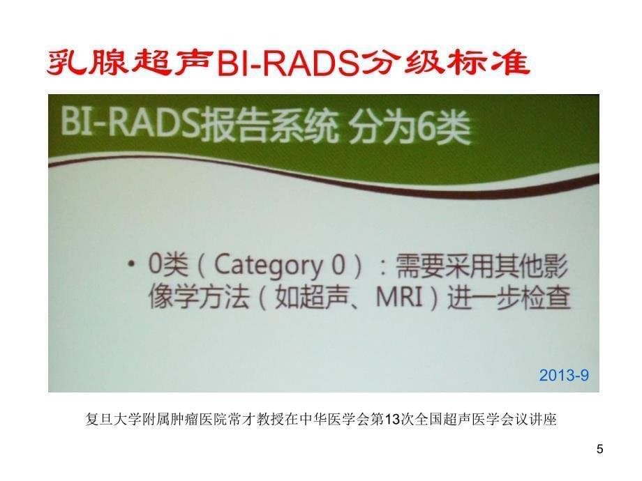 《精编》乳腺超声BI-RADS分类解读与诊断方法_第5页