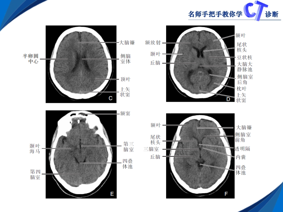 第二章颅脑PPT课件_第3页