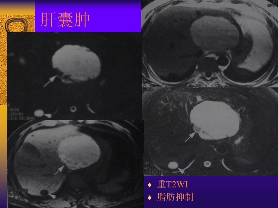 腹部疾病的诊断PPT课件_第3页