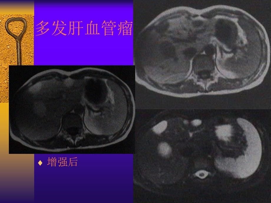 腹部疾病的诊断PPT课件_第5页