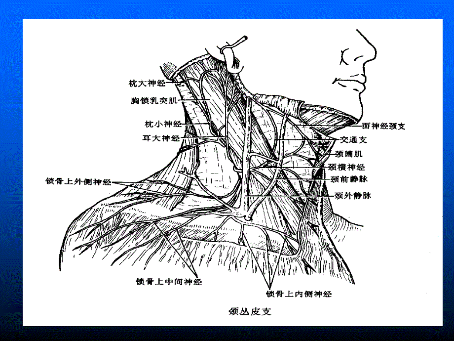 臂丛神经阻滞麻醉详解PPT课件_第3页