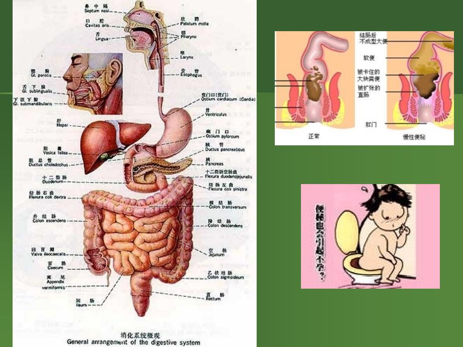 便秘中医PPT课件_第2页