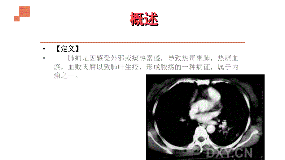 肺痈课件PPT课件_第2页