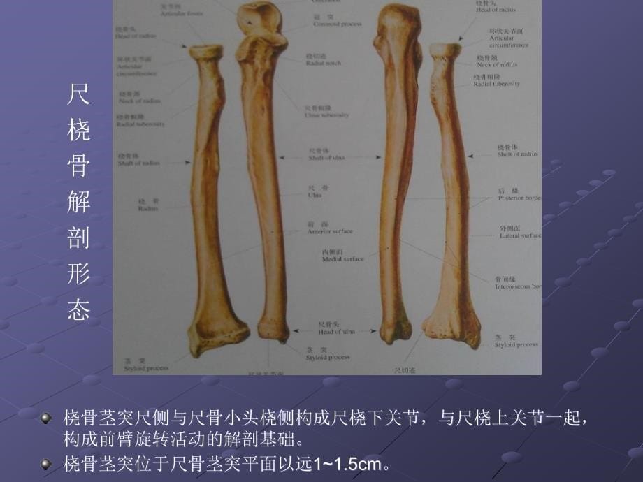 桡骨下段骨折PPT课件_第5页