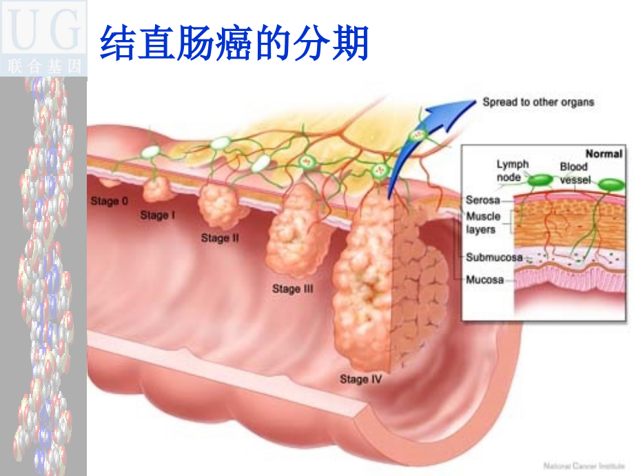 慢性病预防的理论与实践基因检测PPT课件_第4页