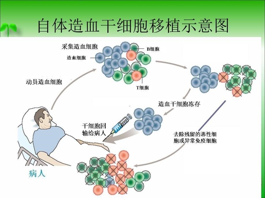 造血干细胞移植的适应症与疗效PPT课件_第5页