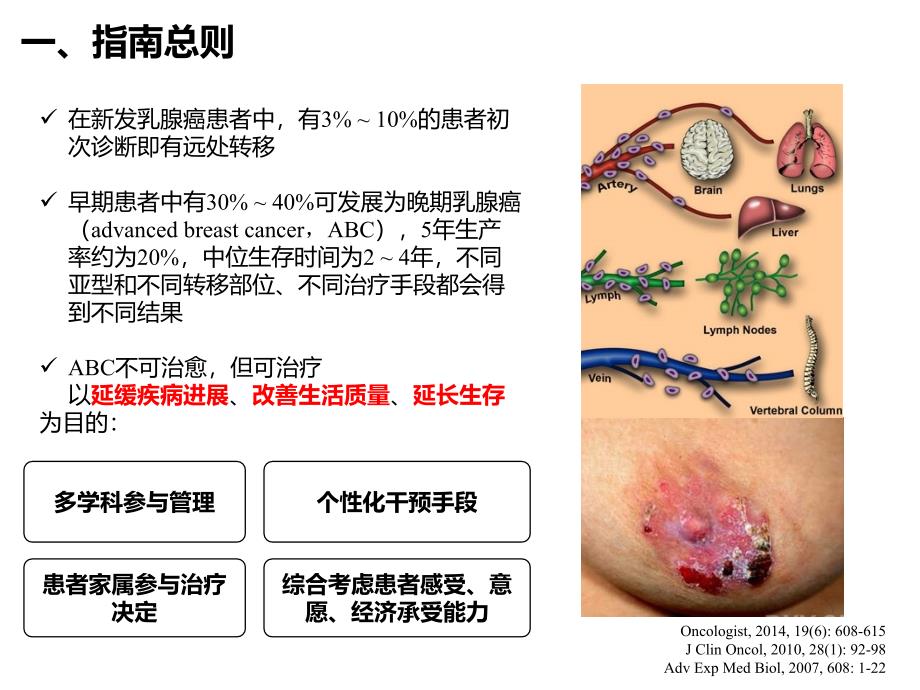 中国晚期乳腺癌临床诊疗专家共识一PPT课件_第4页