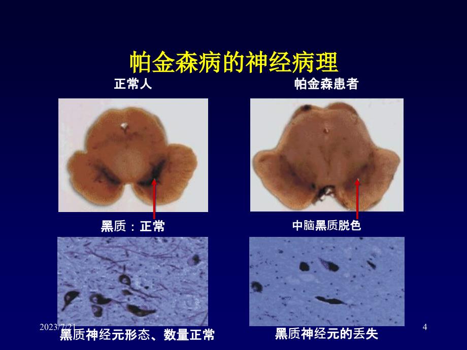 诊断治疗PPT课件_第4页