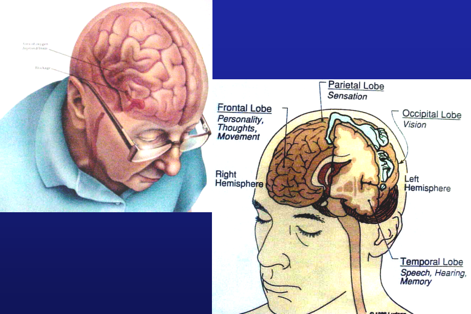 颅脑损伤教学PPT课件_第2页
