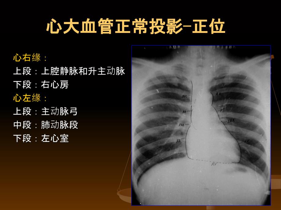 医学影像学循环系统实习ppt课件_第3页