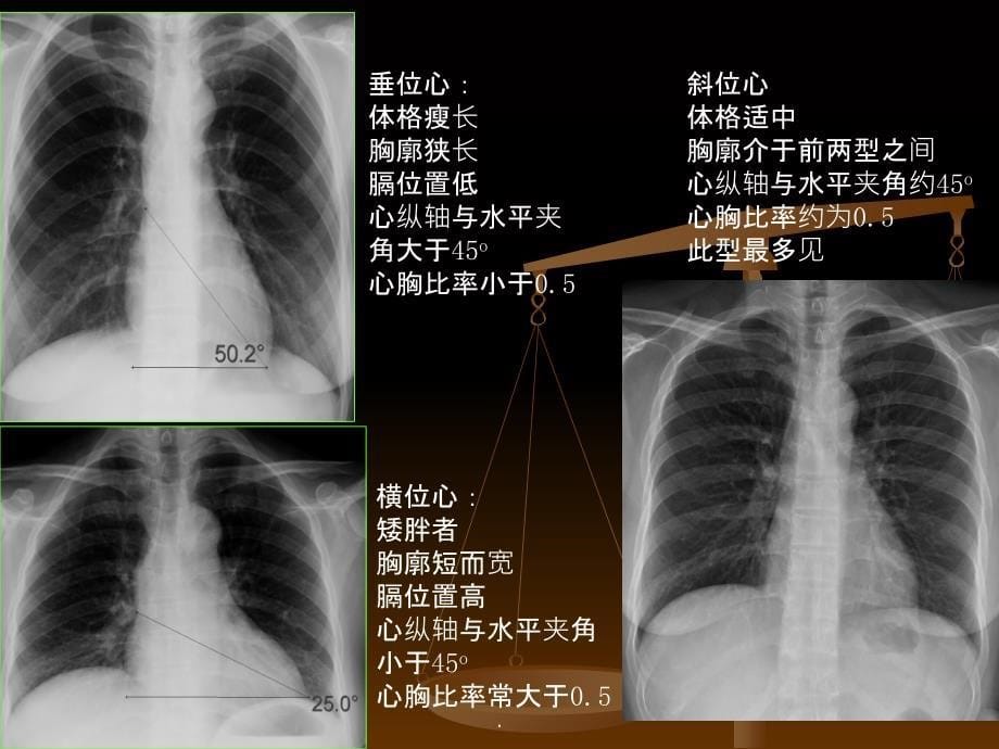 医学影像学循环系统实习ppt课件_第5页