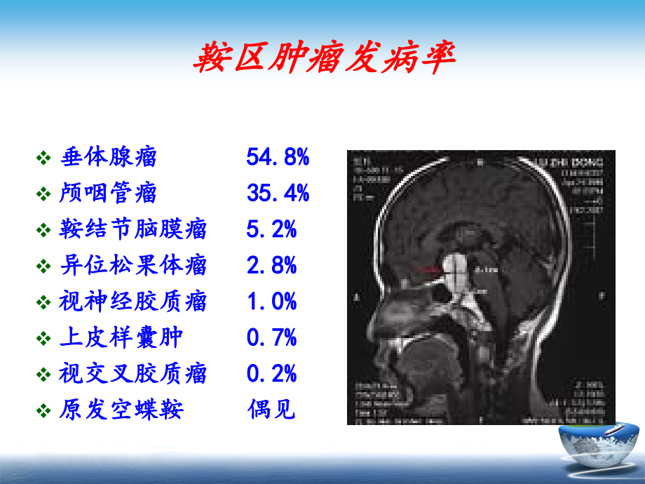 颅咽管瘤-目前网上最好的备课讲稿_第4页